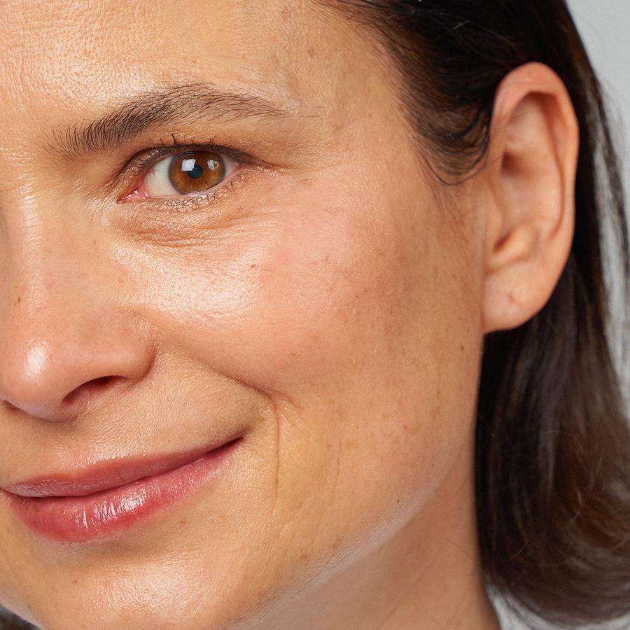 Novexpert HYALURONIC Smoothing Toning Mist; lähikuva keski-ikäisen naisen kasvoista, iho selkeän näköinen, hienovarainen hymy, ruskea silmä ja näkyvät hienot juonteet; tummat hiukset korvan taakse työnnettyinä; ei näkyviä esineitä tai tekstiä kasvojen lisäksi; neutraali tausta, valokuvamainen suoraviivainen kuvatyyli.