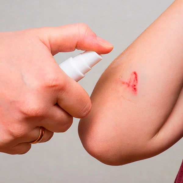 Terveyskaista HOIVA® Antiseptinen Suihke; käsi suihkuttaa antiseptiä lapsen naarmuuntuneelle kyynärpäälle tuoreen punaisen haavan hoitamiseksi infektion ehkäisemiseksi; tuote pienessä muovisessa suihkepullossa, jossa valkoinen läpikuultava runko ja matta pinta; ei näkyvää etikettiä; tausta epätarkka, sisätila; lähikuva näyttää vain aikuisen käden, suihkepullon ja osan lapsen käsivarresta.